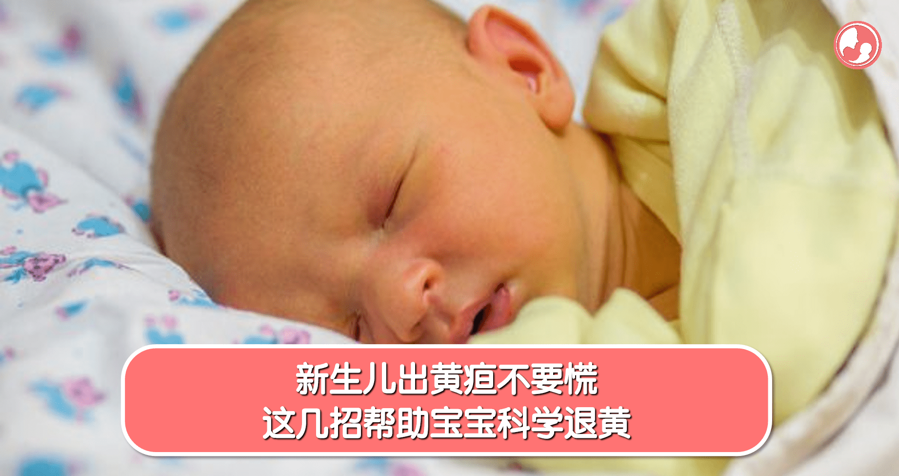 【黄疸篇】新生儿出黄疸不要慌，这几招帮助宝宝科学退黄 -MamaClub