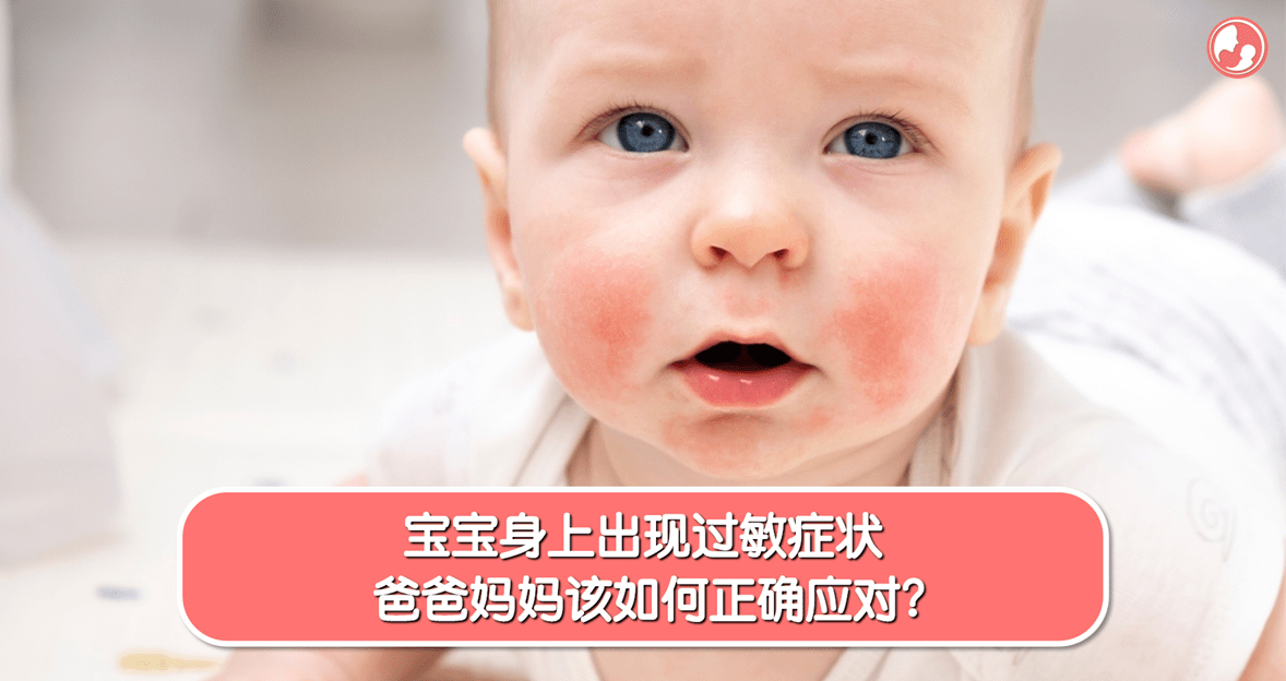 【皮肤敏感】宝宝身上出现过敏症状，爸爸妈妈该如何正确应对？ -MamaClub
