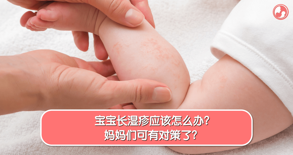 【湿疹篇】宝宝长湿疹应该怎么办？妈妈们可有对策了？-MamaClub