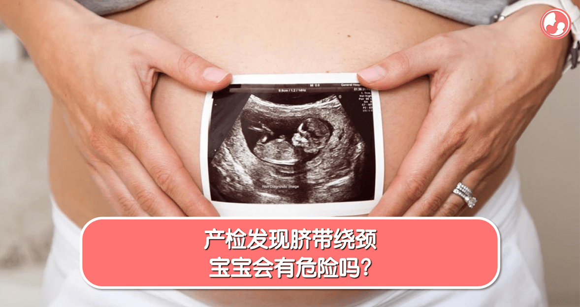 【脐带绕颈】产检发现脐带绕颈，宝宝会有危险吗？ -MamaClub