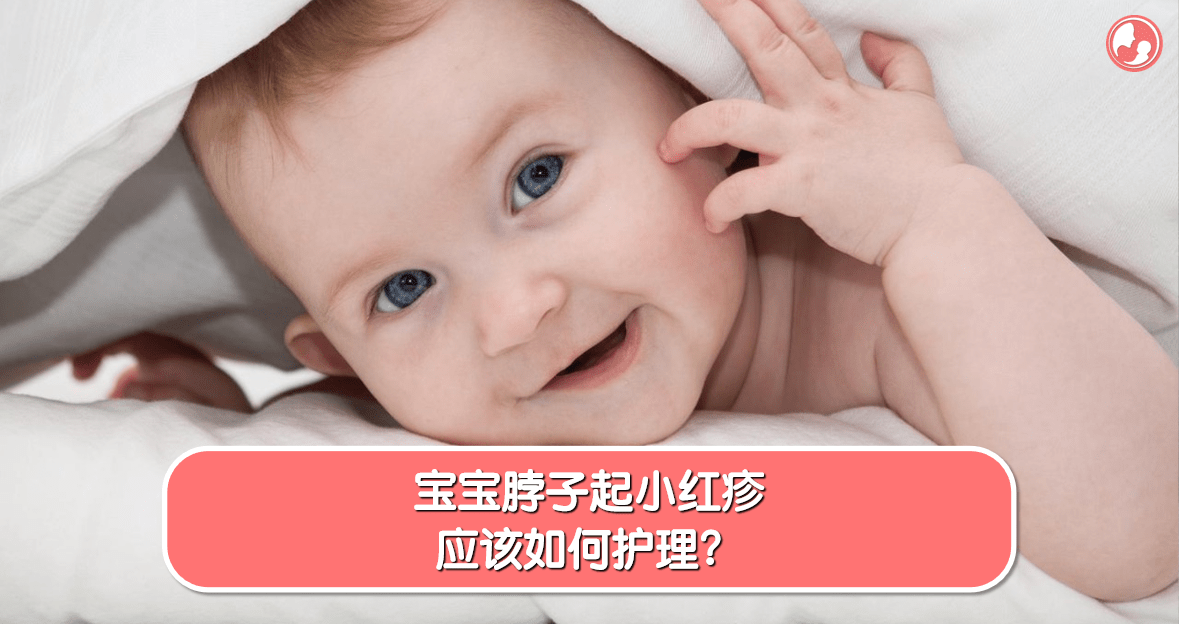 【湿疹篇】宝宝脖子起小红疹，应该如何护理？ -MamaClub