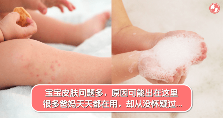 宝宝皮肤出现红疹