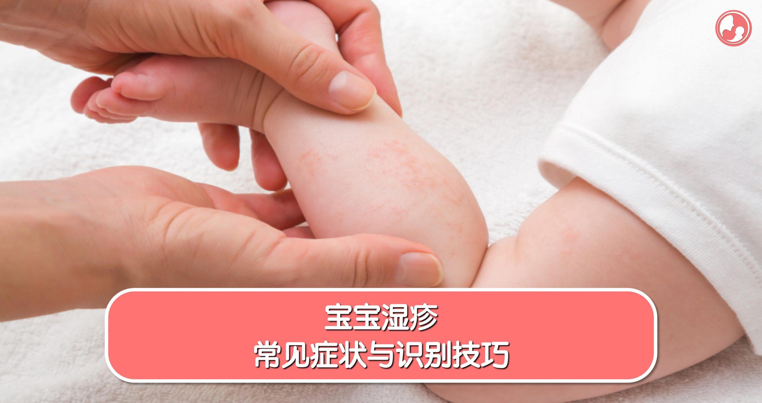 宝宝湿疹常见症状与识别技巧 -MamaClub