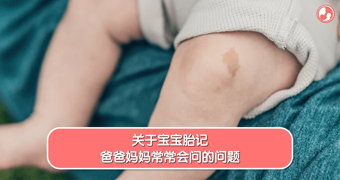 【胎记篇】关于宝宝胎记，爸爸妈妈常常会问的问题 -MamaClub