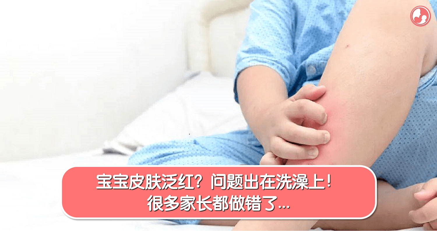 宝宝皮肤泛红？问题出在洗澡上！很多家长都做错了… -MamaClub