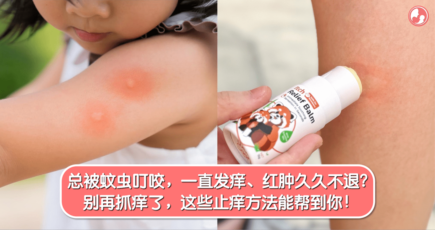 总被蚊虫叮咬，一直发痒、红肿久久不退？别再抓痒了，这些止痒方法能帮到你！ -MamaClub