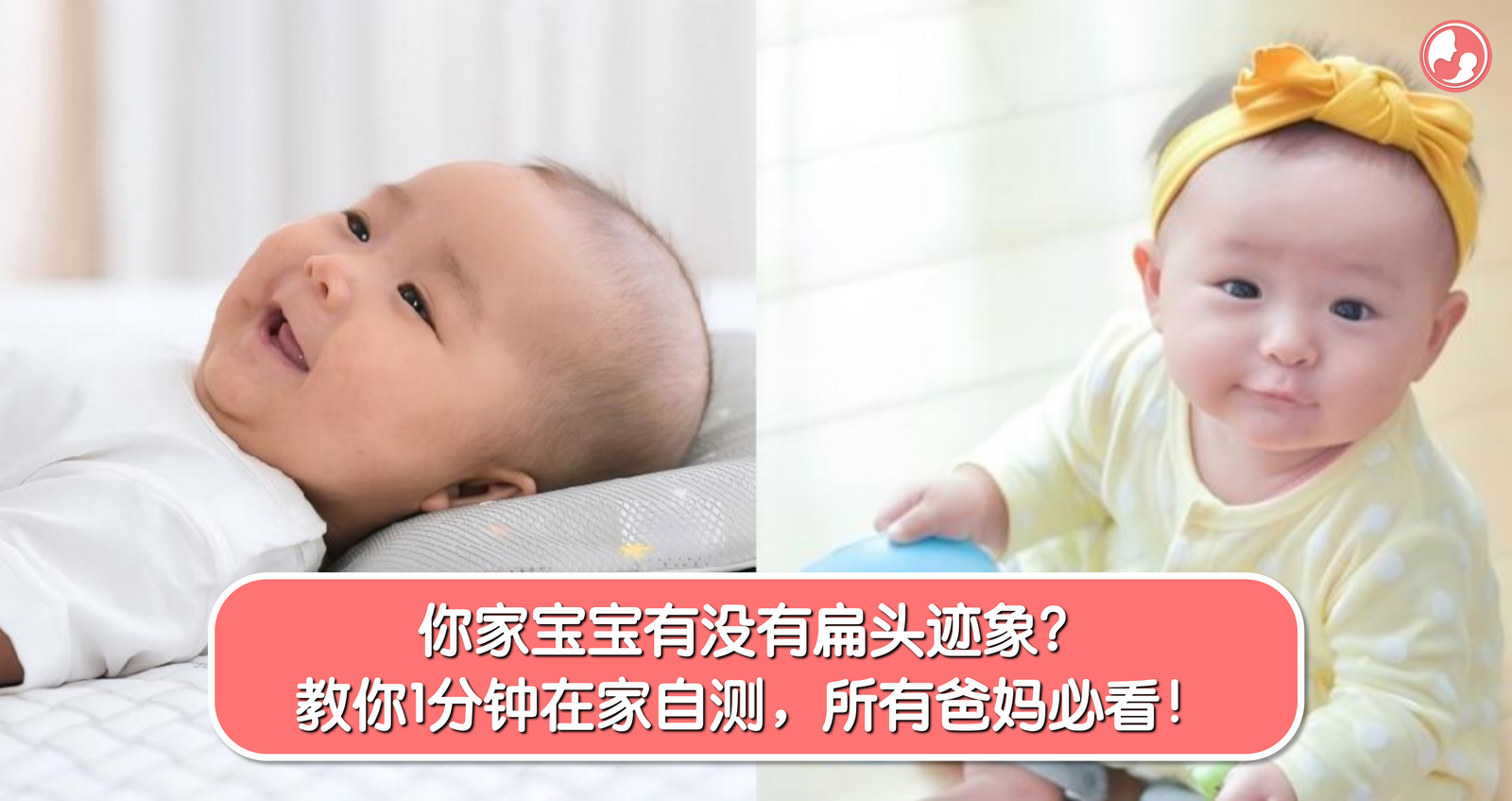 你家宝宝有没有扁头迹象？教你1分钟在家自测，所有爸妈必看！ -MamaClub